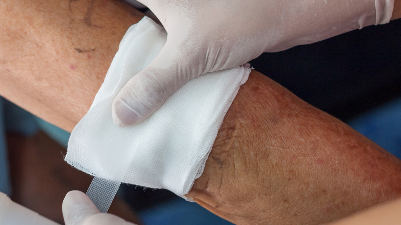 nurse treating a wound on patient