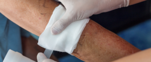 nurse treating a wound on patient